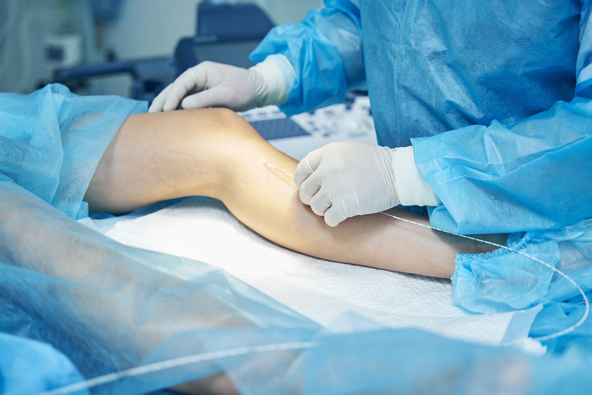 Vein Therapy in Temecula: Transform Your Legs